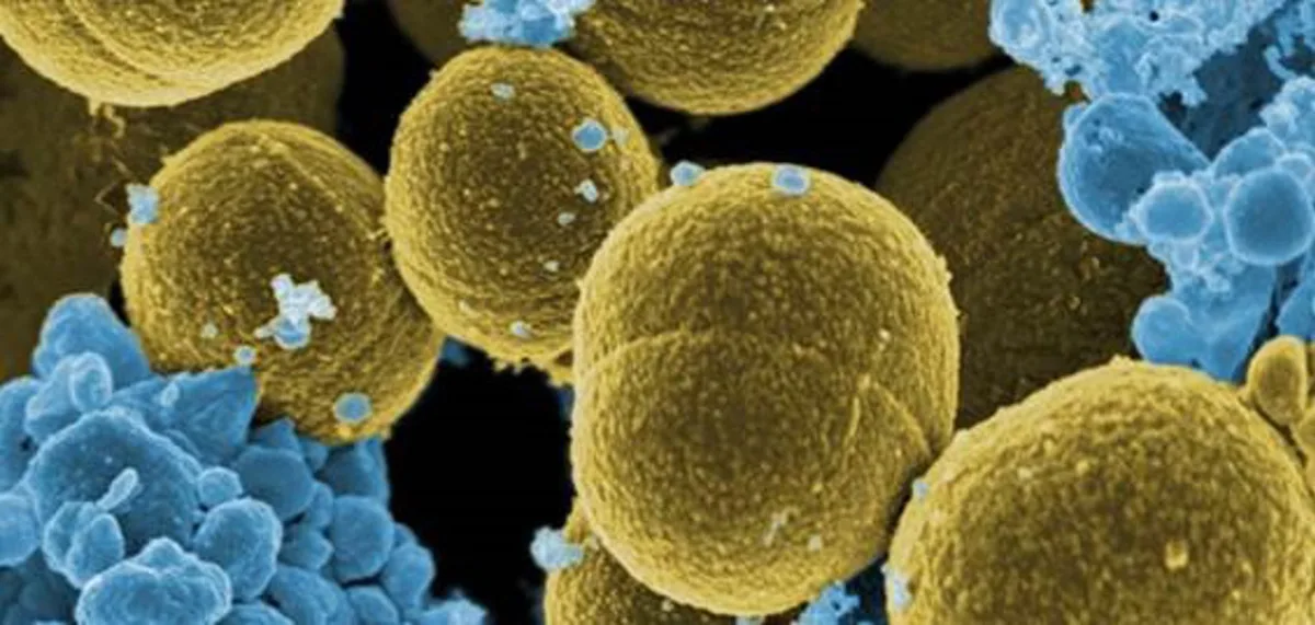 El CSIC desarrolla nuevos materiales antimicrobianos para prevenir infecciones sin favorecer resistencias