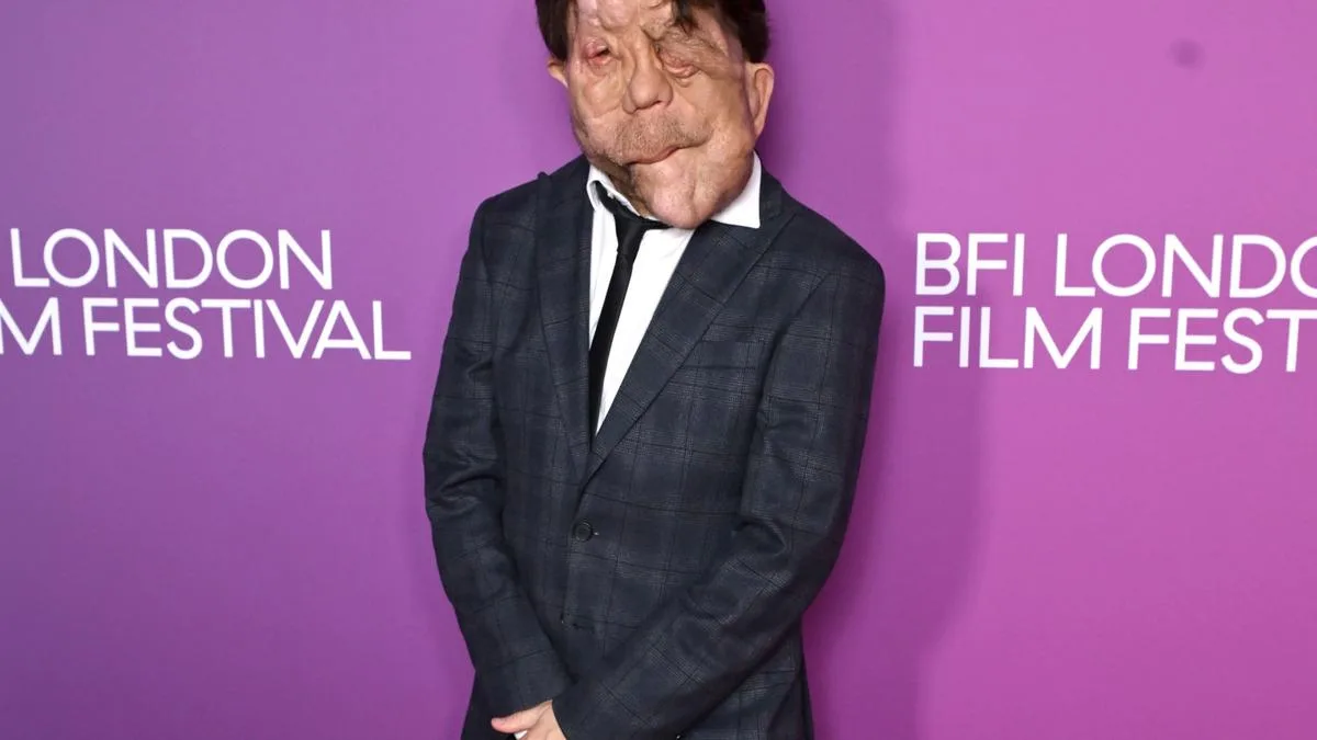 Adam Pearson hails positive disability representation progress in film industry