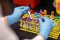 Los tratamientos contra el cáncer de sangre han logrado en 75 años: 25,8 millones de años de vida ganados