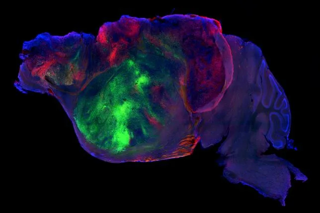 Des souris avec un cerveau mi-humain au service de la médecine