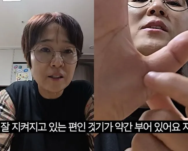 ‘53세’ 송은이, 다이어리 못 쓸 정도?..결국 수술 “방아쇠수지증후군 걸려” (비보티비)