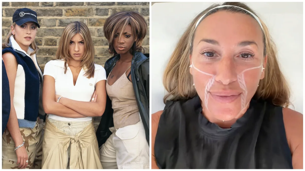 ‘90s Pop Star, 51, Shows Results of 'Nonsurgical Facelift'