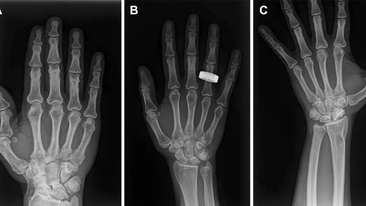 For the first time in history, astronauts use portable X-ray technology in space
