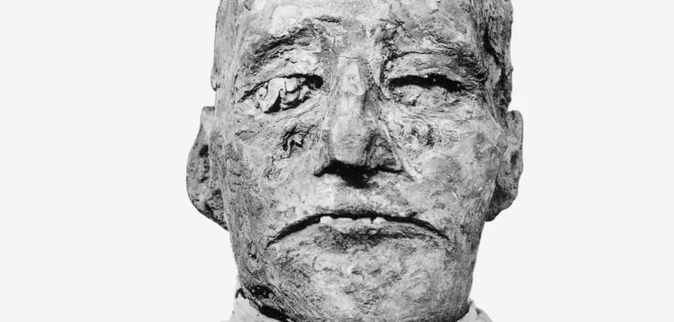 „Dem Pharao wurden sämtliche Weichteile an der Vorderseite des Halses durchtrennt“