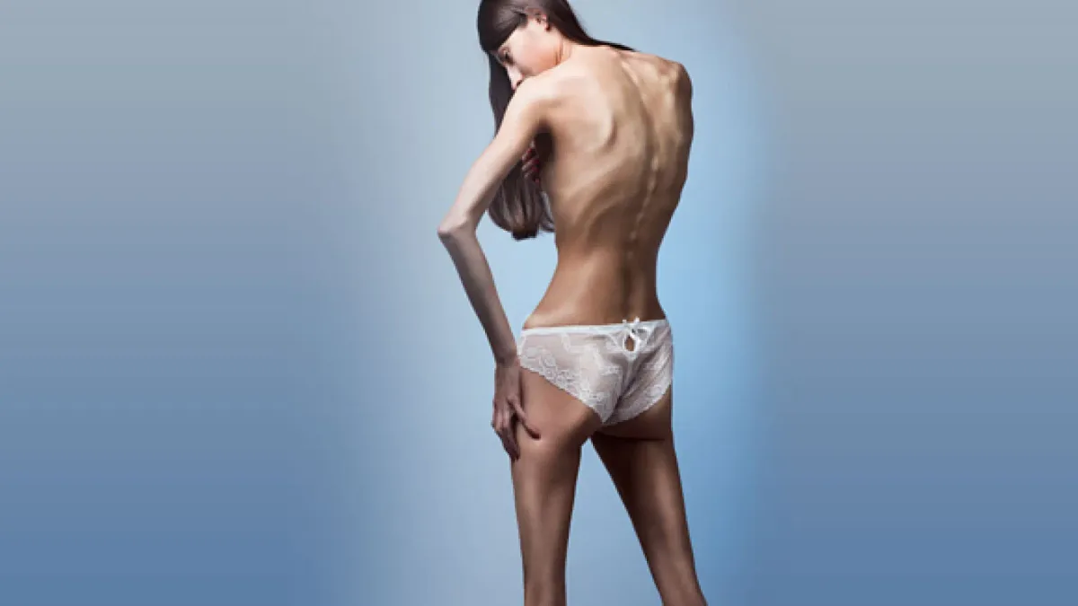 Descubren un gen relacionado con la anorexia que actúa en la grasa y no en el cerebro