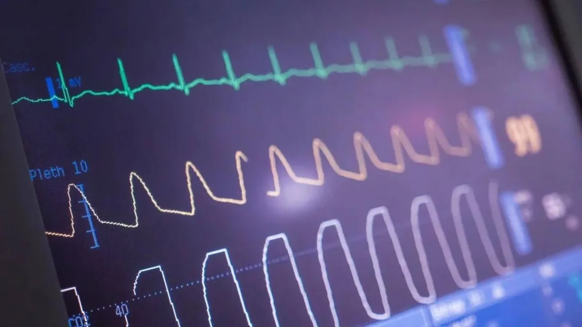 Heart ablation cuts irregular beats, but may not make patients feel better