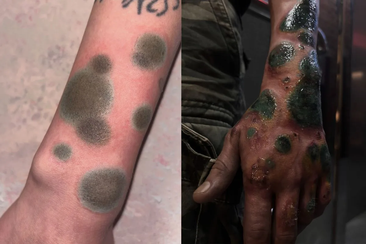 Tendência? Tatuagens que imitam manchas de mofo causam estranhamento na web