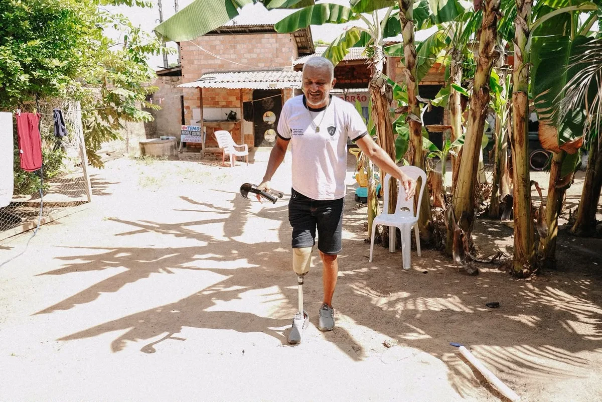 Líder comunitário que teve perna amputada consegue prótese com apoio da DPE-RR: 'mudou a minha vida'