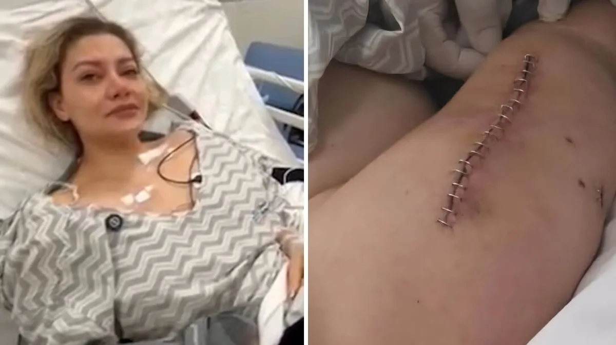 Tras la carta de Fernando Cerimedo, Nadia Beller mostró nuevas fotos de las heridas que sufrió en el ataque: “Que Dios te perdone”