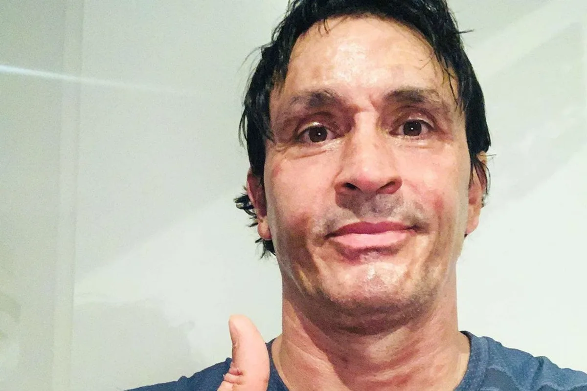 Sebastián Estevanez recordó los dramáticos accidentes en los que casi pierde la vida: “Me prendí fuego”