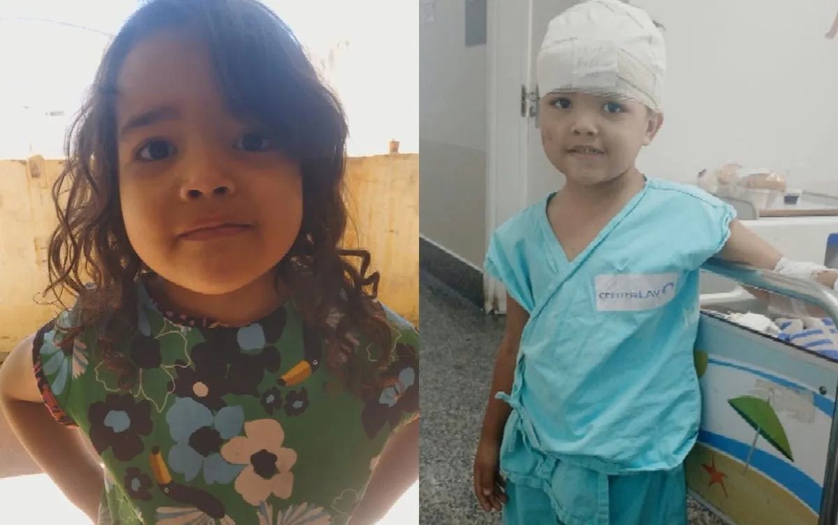 Menina de 4 anos é atacada por pit bull em casa
