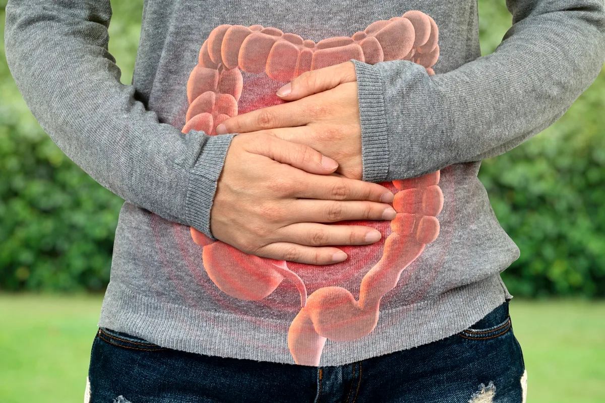 Câncer de intestino antes dos 50 tem tumor diferente e maior sobrevida