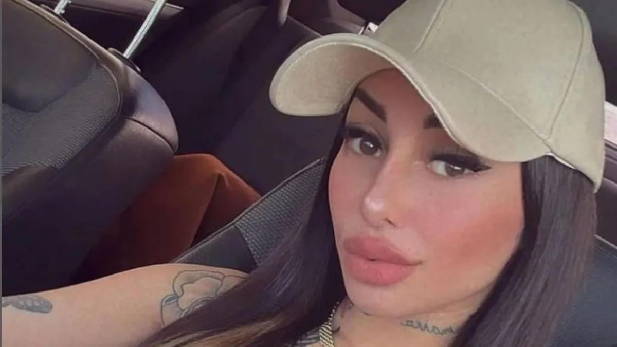 Tamara Báez habló de las consecuencias de la abdominoplastía en su embarazo: “Mi panza no está normal”
