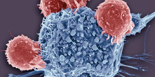 Une nouvelle arme des cellules cancéreuses découverte : l’émission d’un antioxydant pour affaiblir les cellules immunitaires
