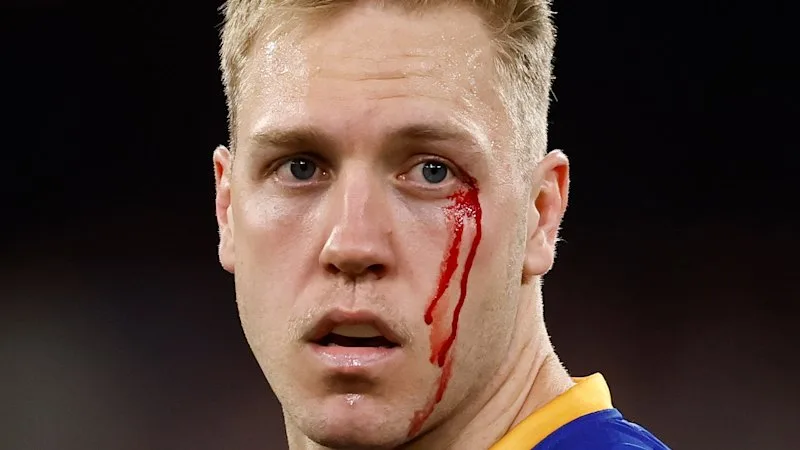 Blood and tears spilled as Lions newcomer rides emotions of pulsating ‘prelim’