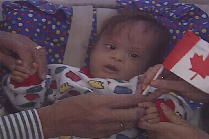 Baby Jose returns to Alberta nearly 30 years after life-saving surgery