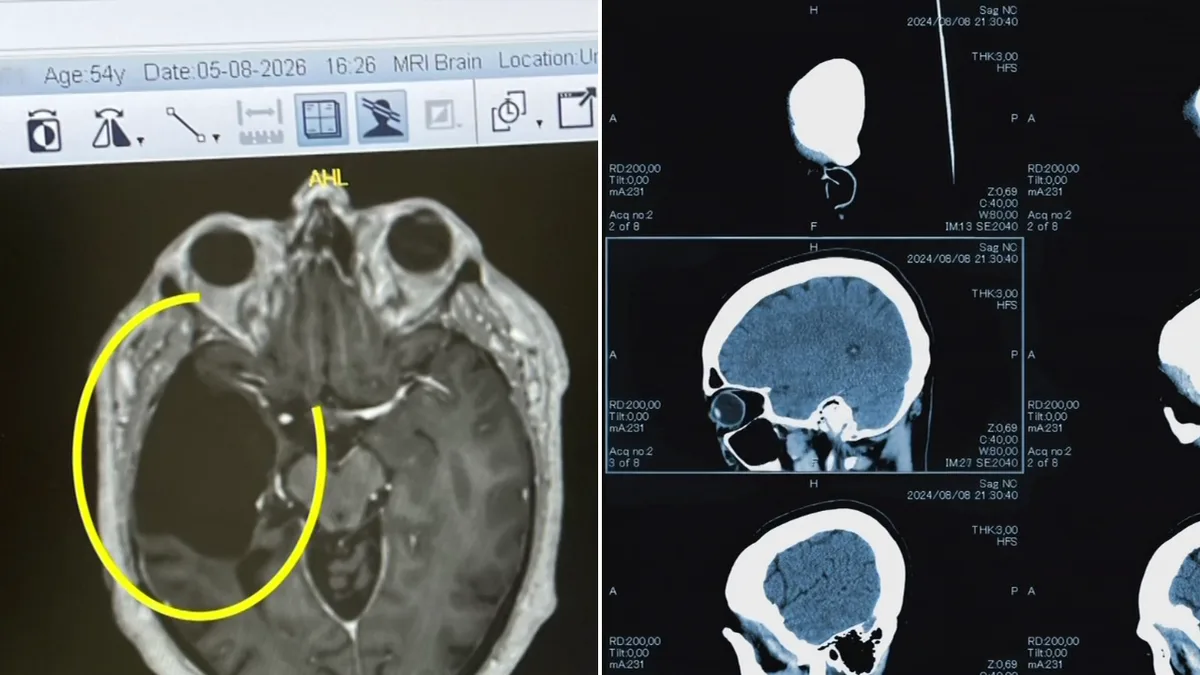 Australian scientists develop breakthrough treatment for deadly brain cancers
