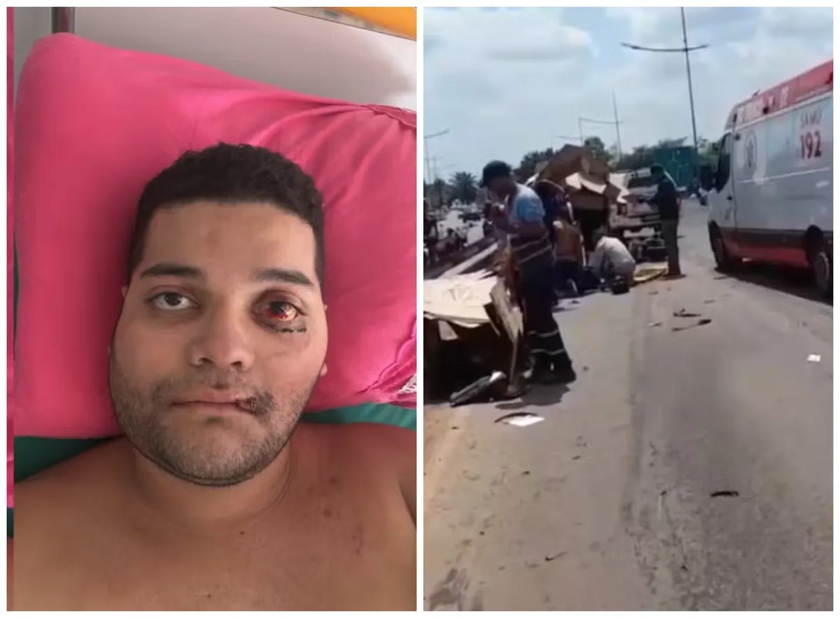 Motociclista envolvido em acidente na BR-364 fraturou rosto e bacia; vítima segue internada