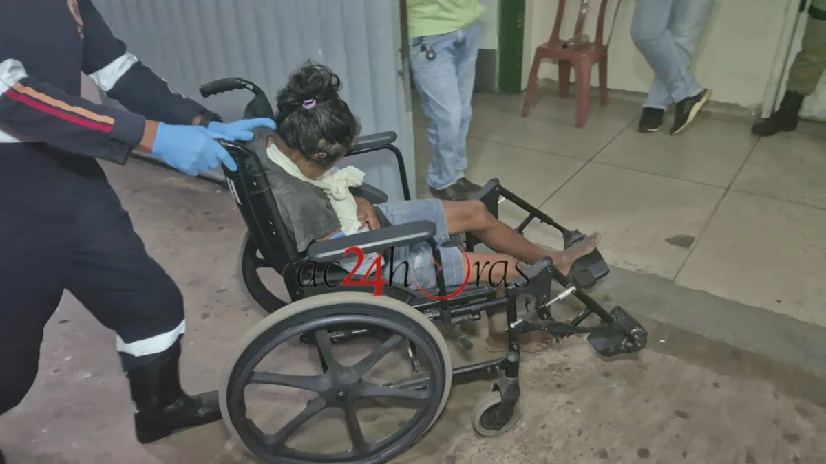 Mulheres são agredidas com ripas no bairro Valdemar Maciel, em Rio Branco