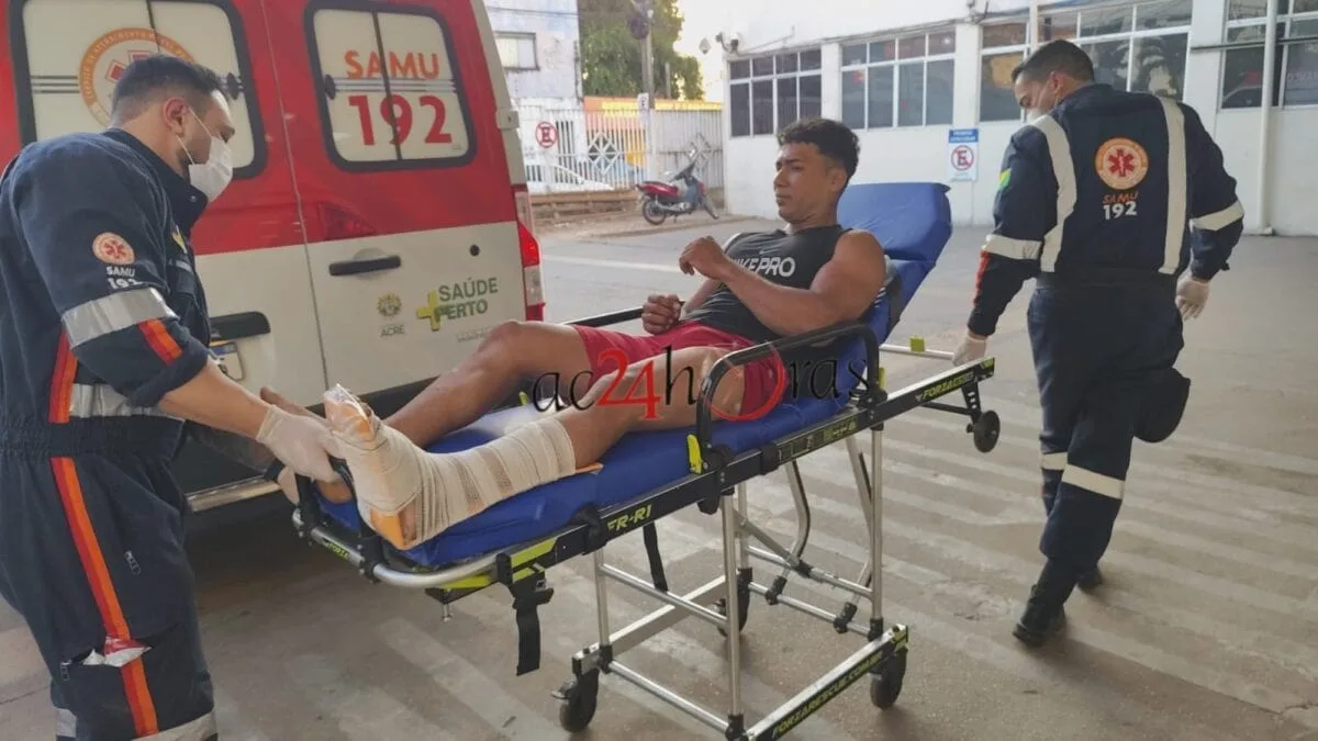 Acidente entre carro e moto deixa casal com fraturas na BR-364