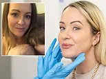 I've used my fair share of Botox but it can only really do one job... so a year ago, I decided to go a step further and find out: Can salmon sperm injections REALLY make me look better aged 47 than I did at 37?