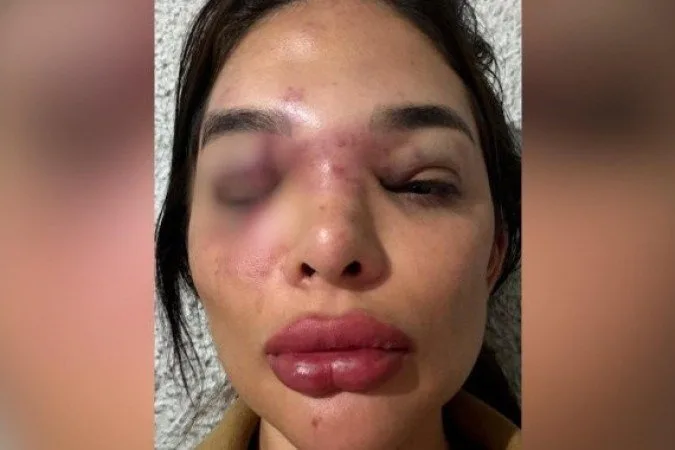 Empresário da Faria Lima vira réu por lesão corporal e ameaça contra a mulher