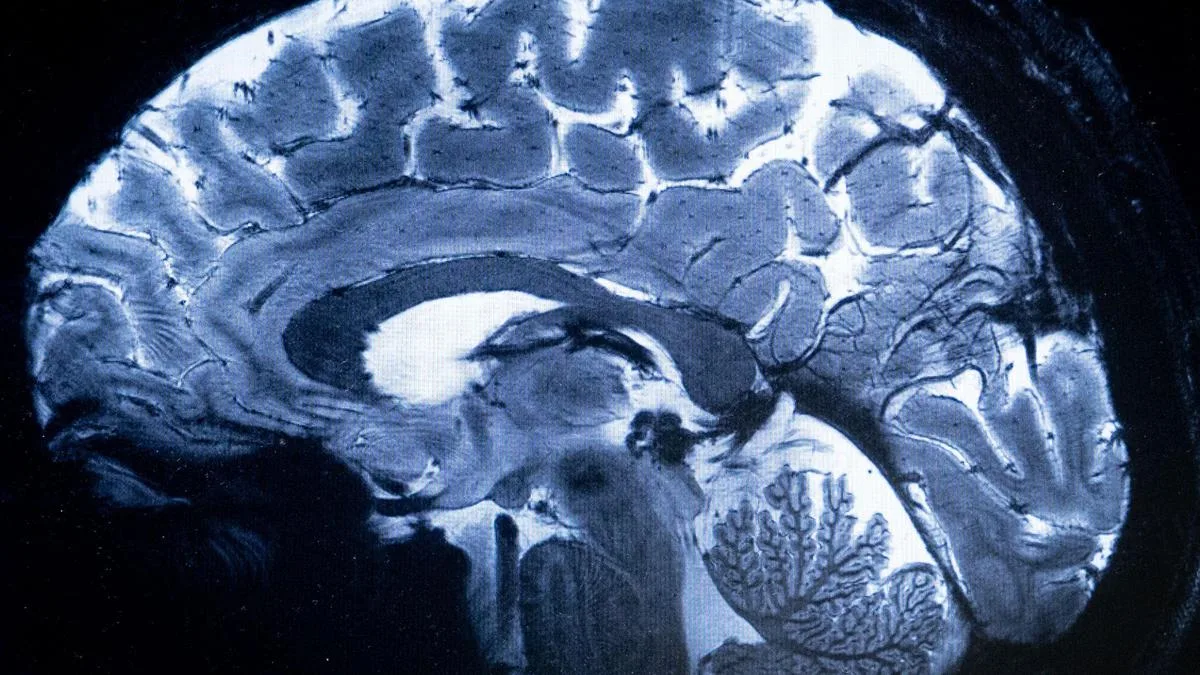 Alzheimer’s blood tests are advancing diagnosis. What can they really tell us?