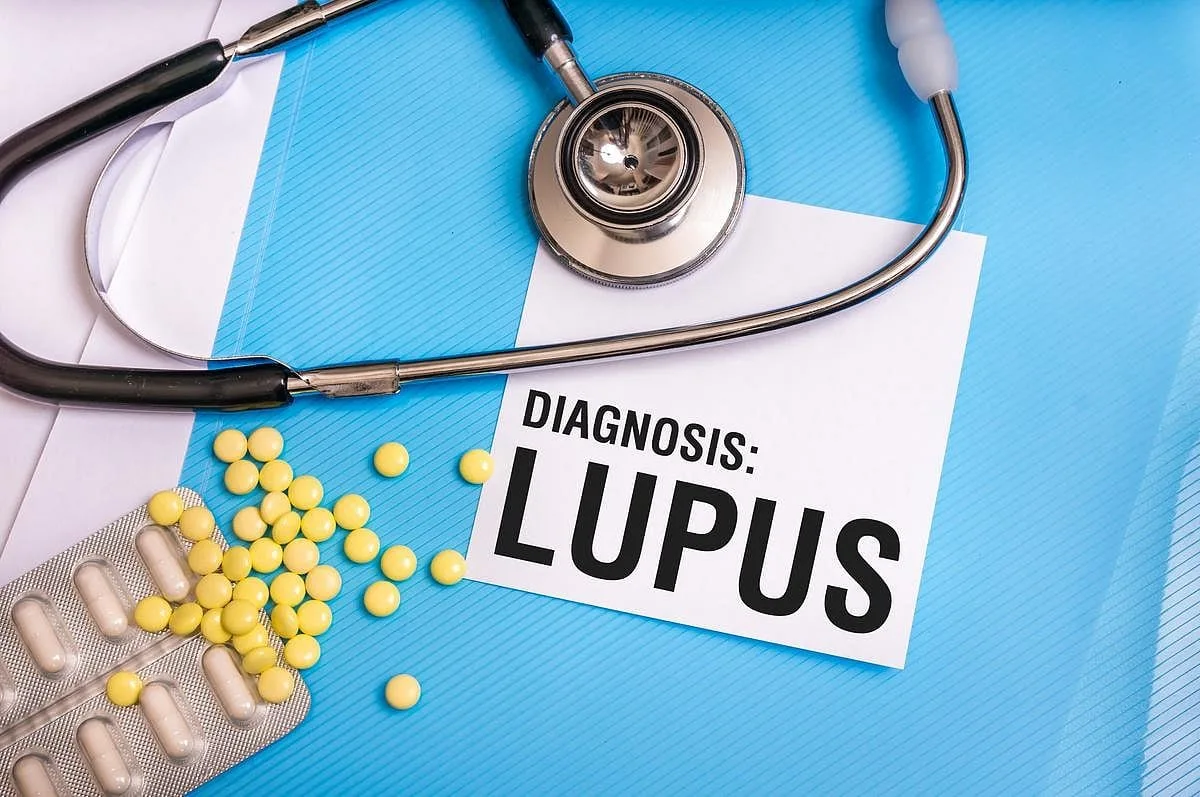 Los pacientes con lupus pueden reducir su riesgo de enfermedad cardíaca si se limitan a un tratamiento común, según un estudio
