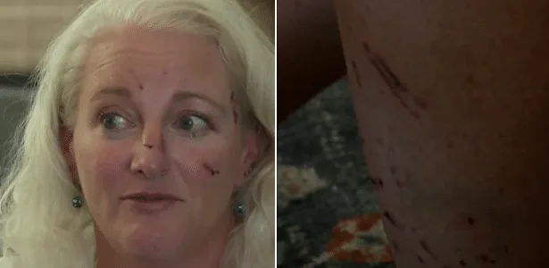 Nadadora leva 38 pontos após ataque de lontra no Lake Tahoe, nos EUA