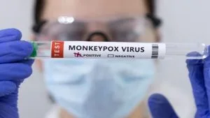 Western Cape strengthens response to Mpox follwing rise in cases