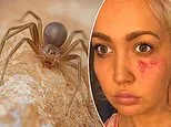 How to survive America's most dangerous spider: They're spreading across US - and you often don't feel them until a wound gapes open and your urine turns black. Here's where they hide in homes... and what you must do immediately after a bite