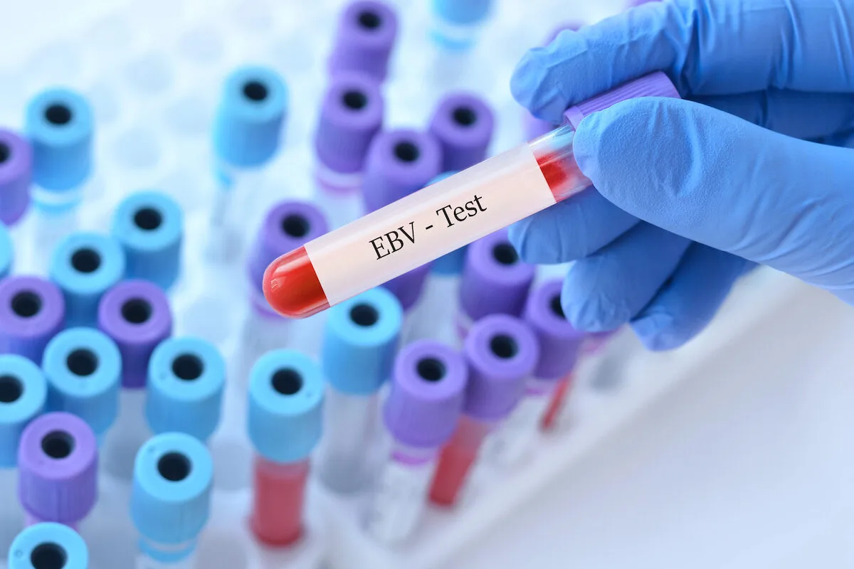 Novo anticorpo trava um vírus que infeta quase toda a humanidade