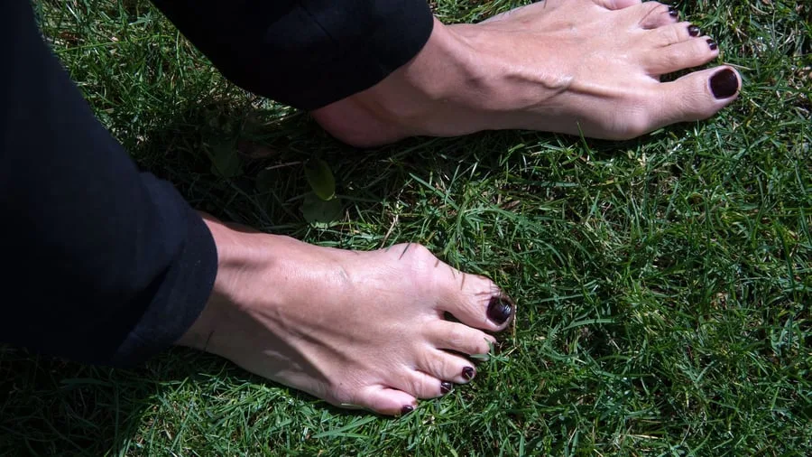 Großer Zeh auf Abwegen: Hallux valgus: Was tun bei familiärer Vorbelastung?