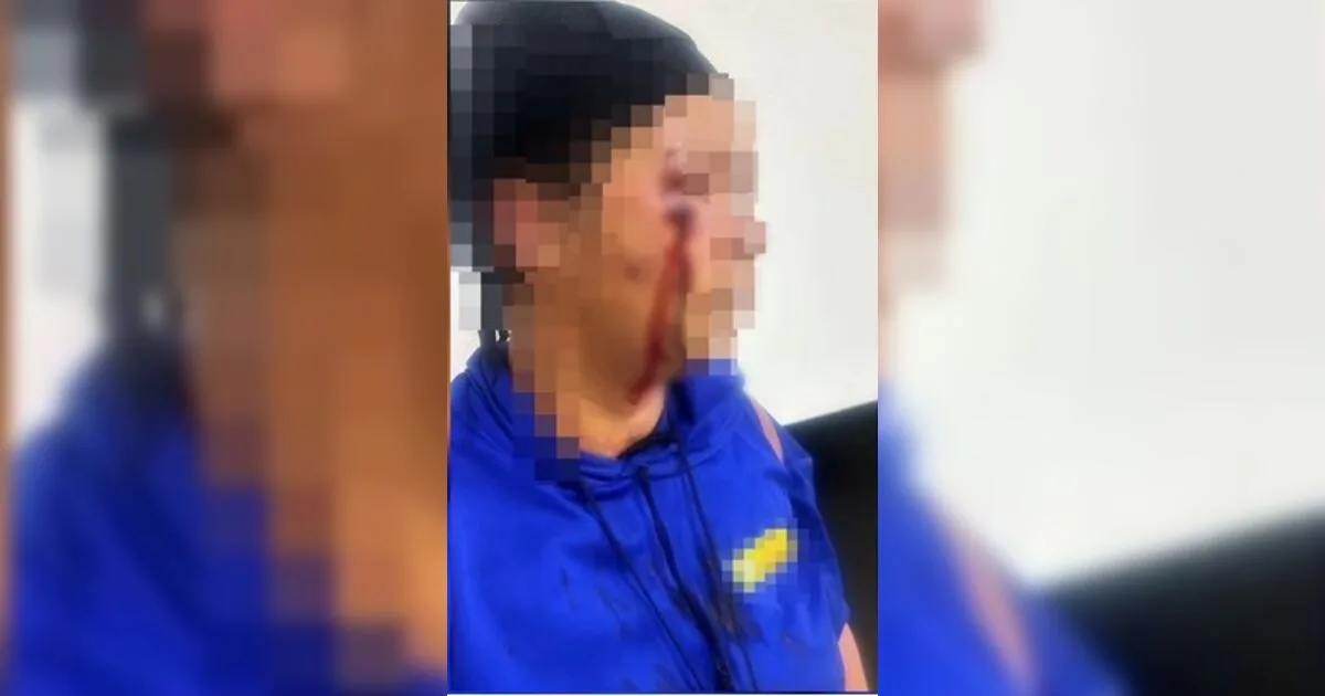 Mulher é chicoteada no rosto por suspeita de relação com homem casado