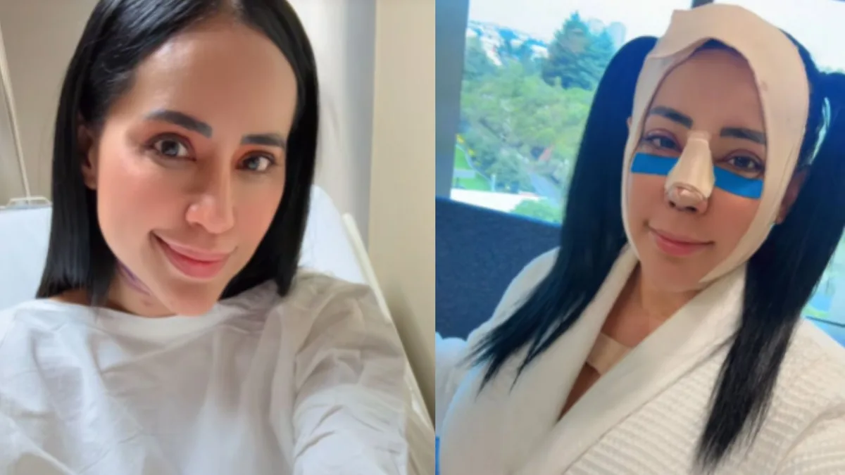 ¿Qué le pasó a Sandra Cuevas? La exalcaldesa reapareció con el rostro vendado tras someterse a una cirugía