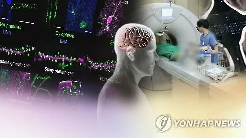 [건강포커스] "수술 전 신체활동 꾸준히 하면 수술 후 섬망 위험 50% 낮아"