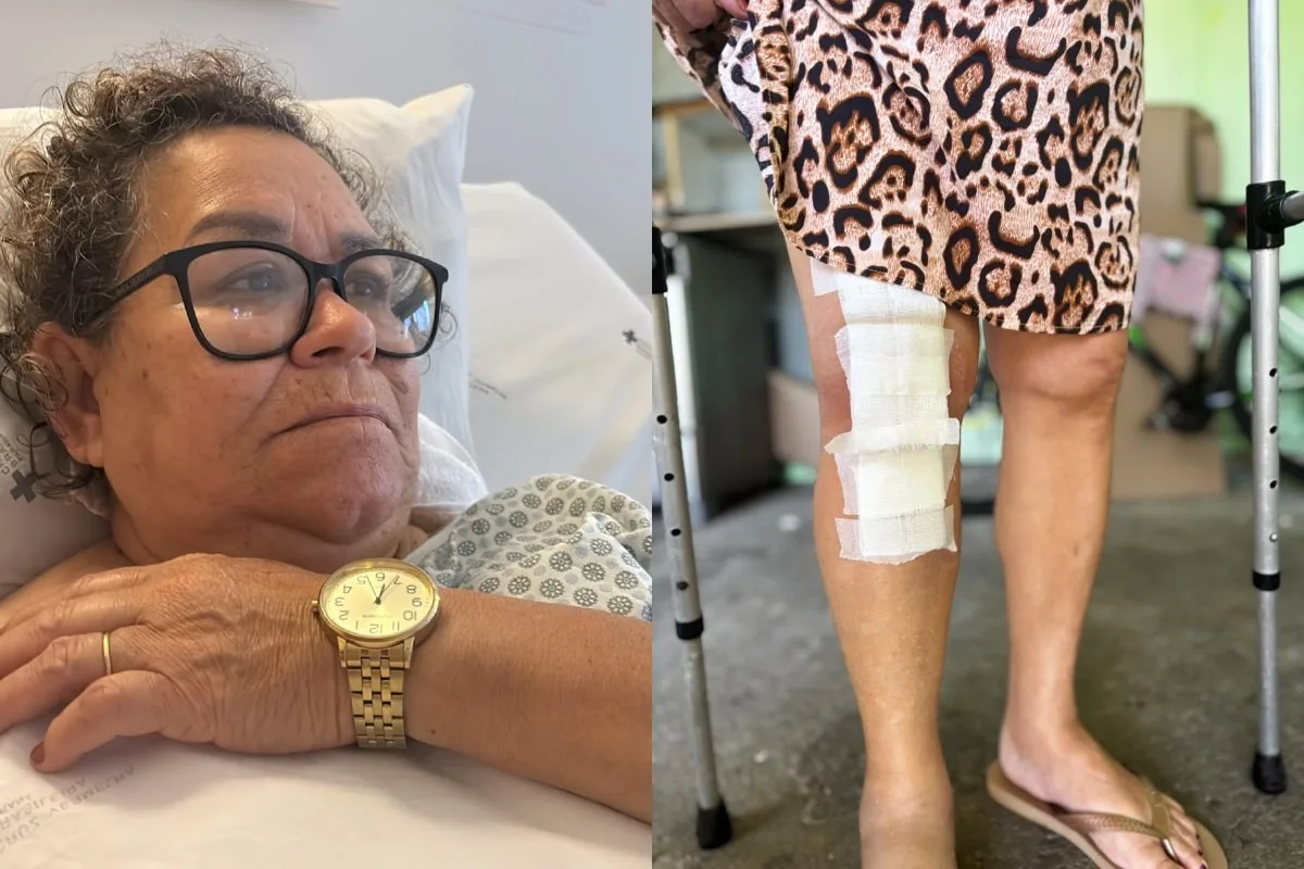 Filha de idosa que teve prótese implantada no joelho errado no PR diz que médico tentou responsabilizar paciente: 'uma culpa que não é dela'