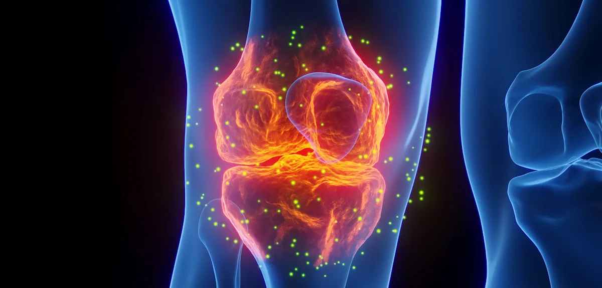 Warum Stress bei manchen Menschen Arthritis auslöst und bei anderen nicht