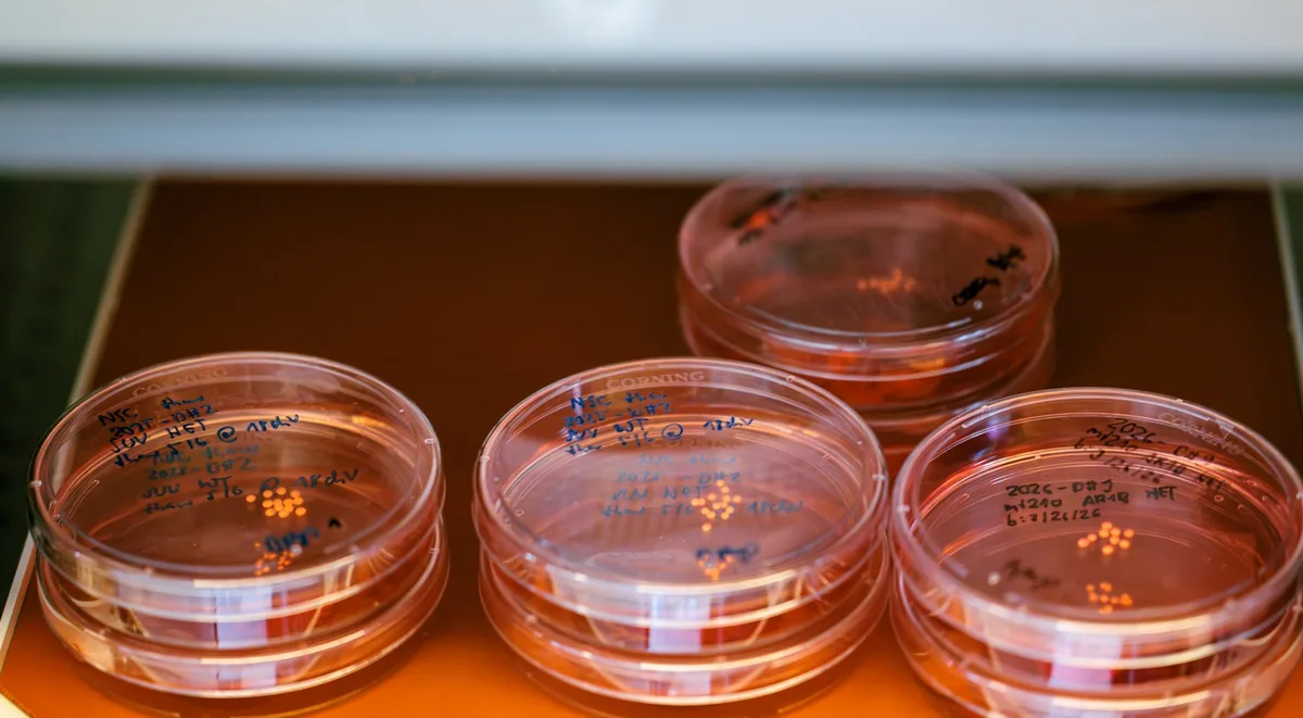 Cientistas conseguem manter mini cérebros vivos por 5 anos e quebram recorde