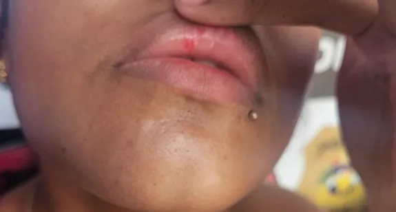 Adolescente é apreendido suspeito de dar soco no rosto de ex-namorada
