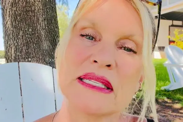 Nicollette Sheridan taken to hospital after nasty dog accident gives her third degree burns