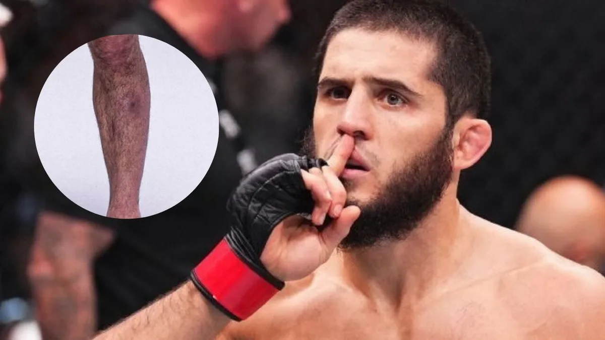 Los estafilococos, la amenaza silenciosa de las MMA