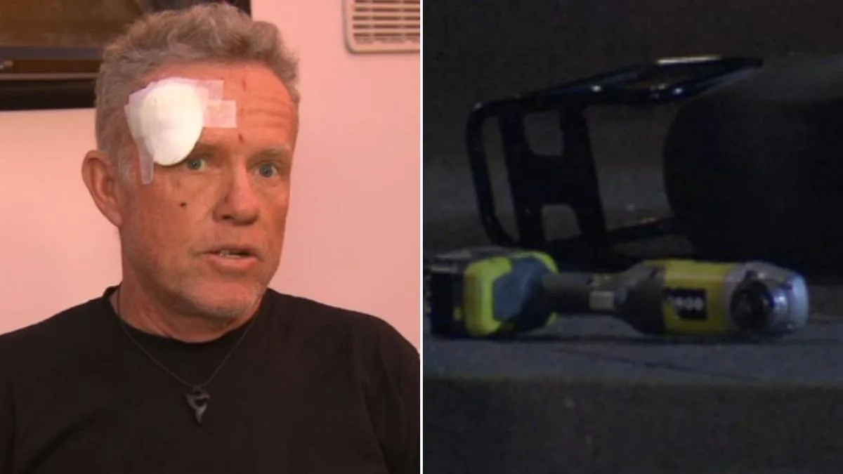 Gold Coast tourist slashed with angle grinder while fighting off would-be e-bike thief at Adelaide caravan park