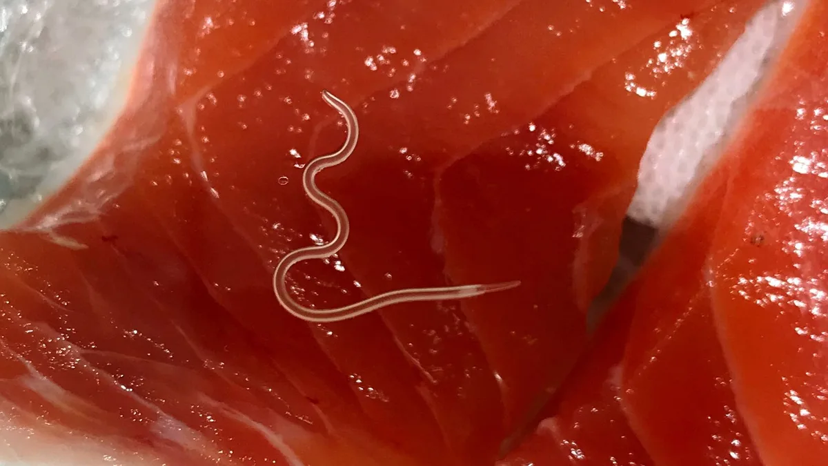 Santiago, experto, sobre el anisakis: "Si quieres comer pescado fresco del mar, cocina especialmente la zona de la ventresca"
