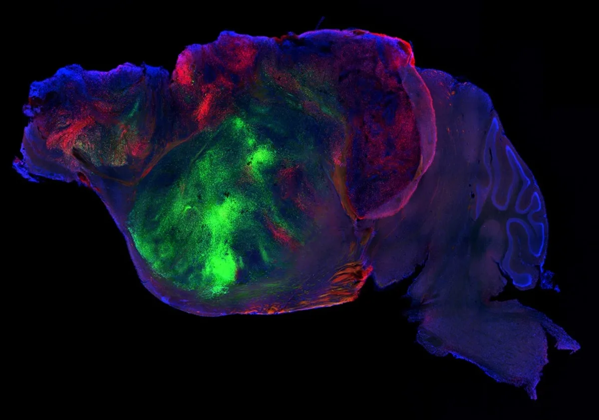 Cientistas fazem neurônios humanos funcionar no cérebro de camundongo