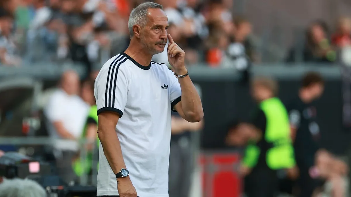 Klopp-Star betroffen - DAS ist Hütters größtes Eintracht-Dilemma