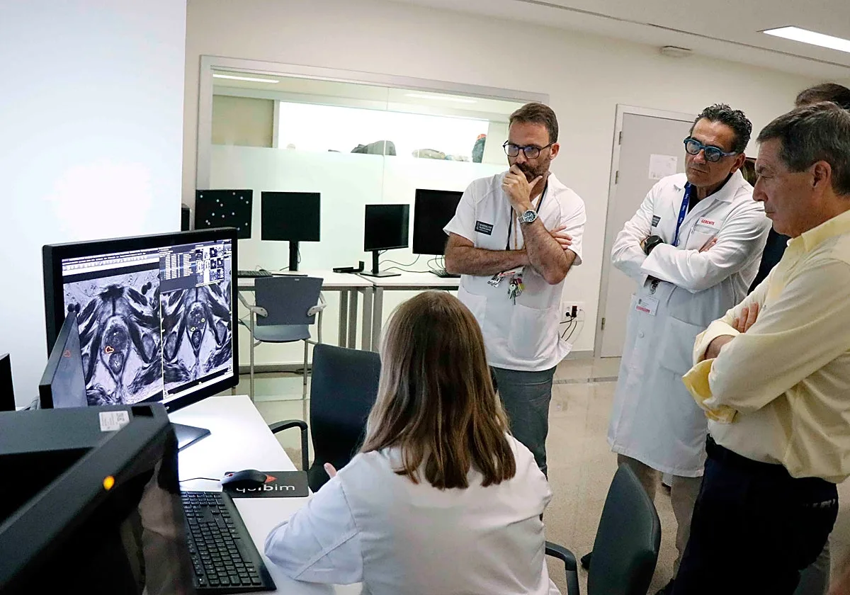 El Hospital La Fe supera los 1.650 casos analizados con inteligencia artificial para diagnosticar el cáncer de próstata