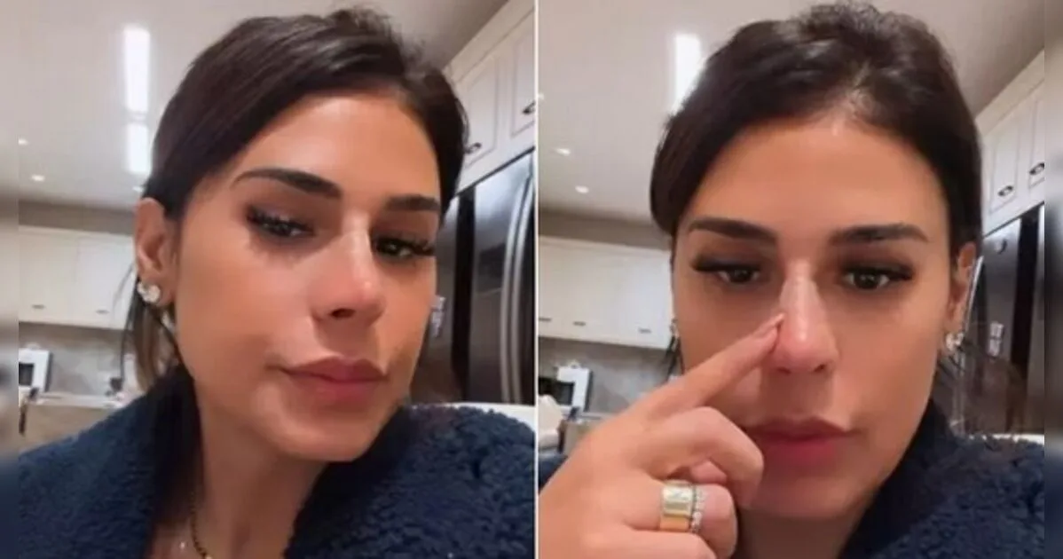 Alvo de comentários negativos, novo nariz de Simone Mendes ganha defesa de Gretchen