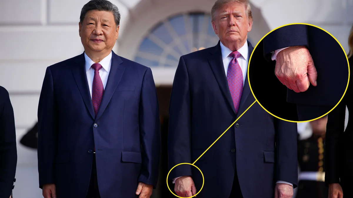Trump Covers Bruised Hand Ahead of White House Meeting With Xi