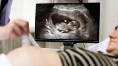 Head of maternity review says 'we will listen to parents'
